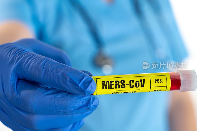 年轻男医生戴着手术手套、防护眼镜和防护口罩手持MERS-CoV (COVID-19)血液检测样管，背景白色